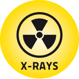 X Rays